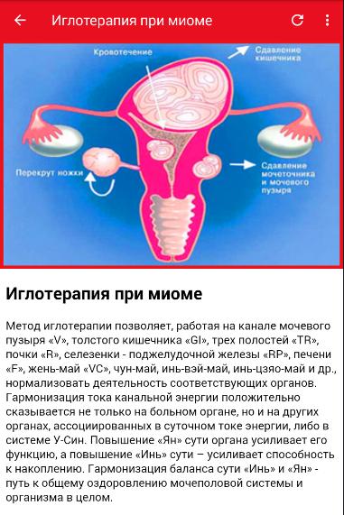 Диета После Миомы