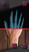 XRay scanner Joke اسکرین شاٹ 3