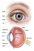 Ophthalmology poster