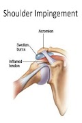 Poster Kinesiologia