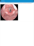 ENT Surgery Atlas скриншот 6