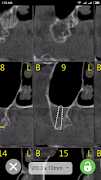 CBCT-Ruler تصوير الشاشة 2