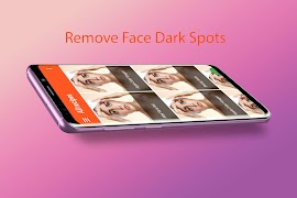 Pimple Remover in 10 days اسکرین شاٹ 1