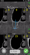 CBCT-Ruler capture d'écran 1