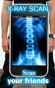 X-Ray Scan Screenshot 5