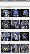 MRI POSITIONING 스크린샷 3
