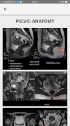 MRI POSITIONING 스크린샷 7