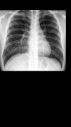 X射線掃描儀 截圖 4