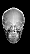 Xray Scanner captura de pantalla 3