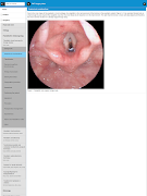 5 Schermata ENT Surgery Atlas