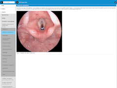 ENT Surgery Atlas screenshot 7