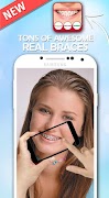 Braces Camera Effects স্ক্রিনশট 1