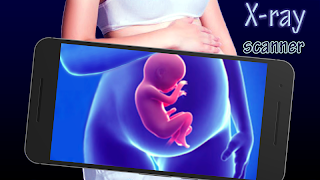 Realistic X-ray scanner gönderen