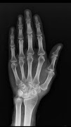 Mobile X-ray Scanner screenshot 4
