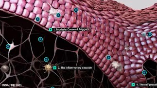 Psoriasis Deep Dive screenshot 2