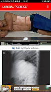 6 Schermata RADIOGRAPHYC POSITIONING ABDOMEN
