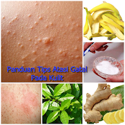 Tips Mencegah Gatal Pada Kulit تصوير الشاشة 1