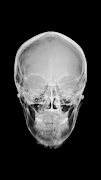 Mobile X-ray Scanner syot layar 7
