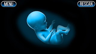 Xray Scanner Pregnant Prank ảnh chụp màn hình 4