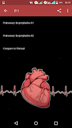 Heart Murmurs Screenshot 4