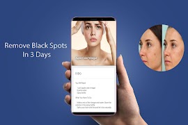 Pimple Remover in 10 days poster