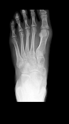 2 Schermata Scanner Xray