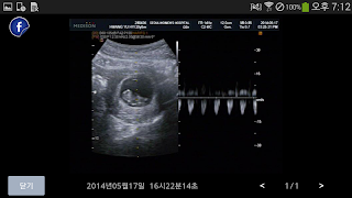 파티마여성병원 screenshot 3