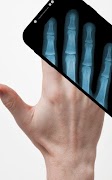 Xray Scanner স্ক্রিনশট 2