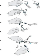 Surgery Stitching Techniques Plakat