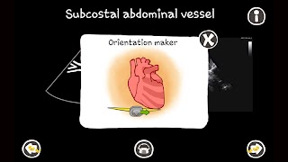 Echo CTT ภาพหน้าจอ 3