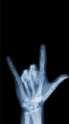 X-Ray skaner aparat żart screenshot 3