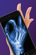 X-ray scanning screenshot 4