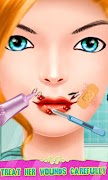 الشفاه جراحة تحول تصوير الشاشة 6
