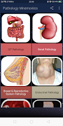 Pathology Mnemonics (Free) screenshot 1