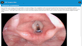 ENT Surgery Atlas تصوير الشاشة 3