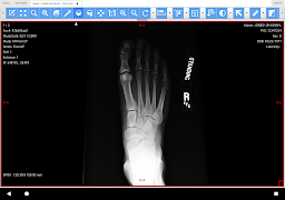 LEADTOOLS MedicalWebViewerDemo ภาพหน้าจอ 3
