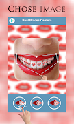 Real Braces Camera screenshot 2