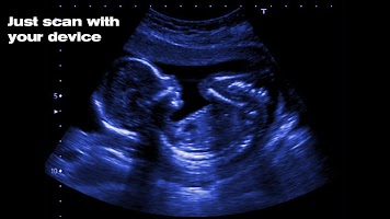 X-Ray Simulator Pregnant Joke screenshot 1