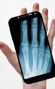 Xray Scanner 스크린샷 1