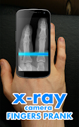 X-Ray Camera Fingers スクリーンショット 5