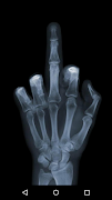 X-Ray Scanner Prank screenshot 6