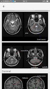 MRI POSITIONING ảnh chụp màn hình 6