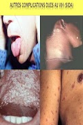 Aids screenshot 2