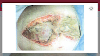 Surgery UCT syot layar 2