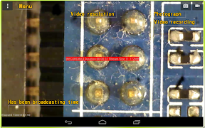 Vitiny Ear Scope penulis hantaran