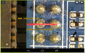 Vitiny Ear Scope imagem de tela 1