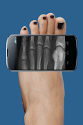 Xray Scan Prank 截圖 3