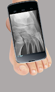 X-Ray Scanner Prank ảnh chụp màn hình 2