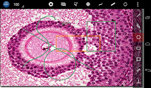 MikroApp Sample ภาพหน้าจอ 6