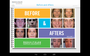 Rodan + Fields Solution Tool 스크린샷 1